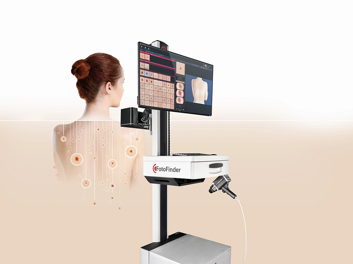 Fotofinder-Feature-Image